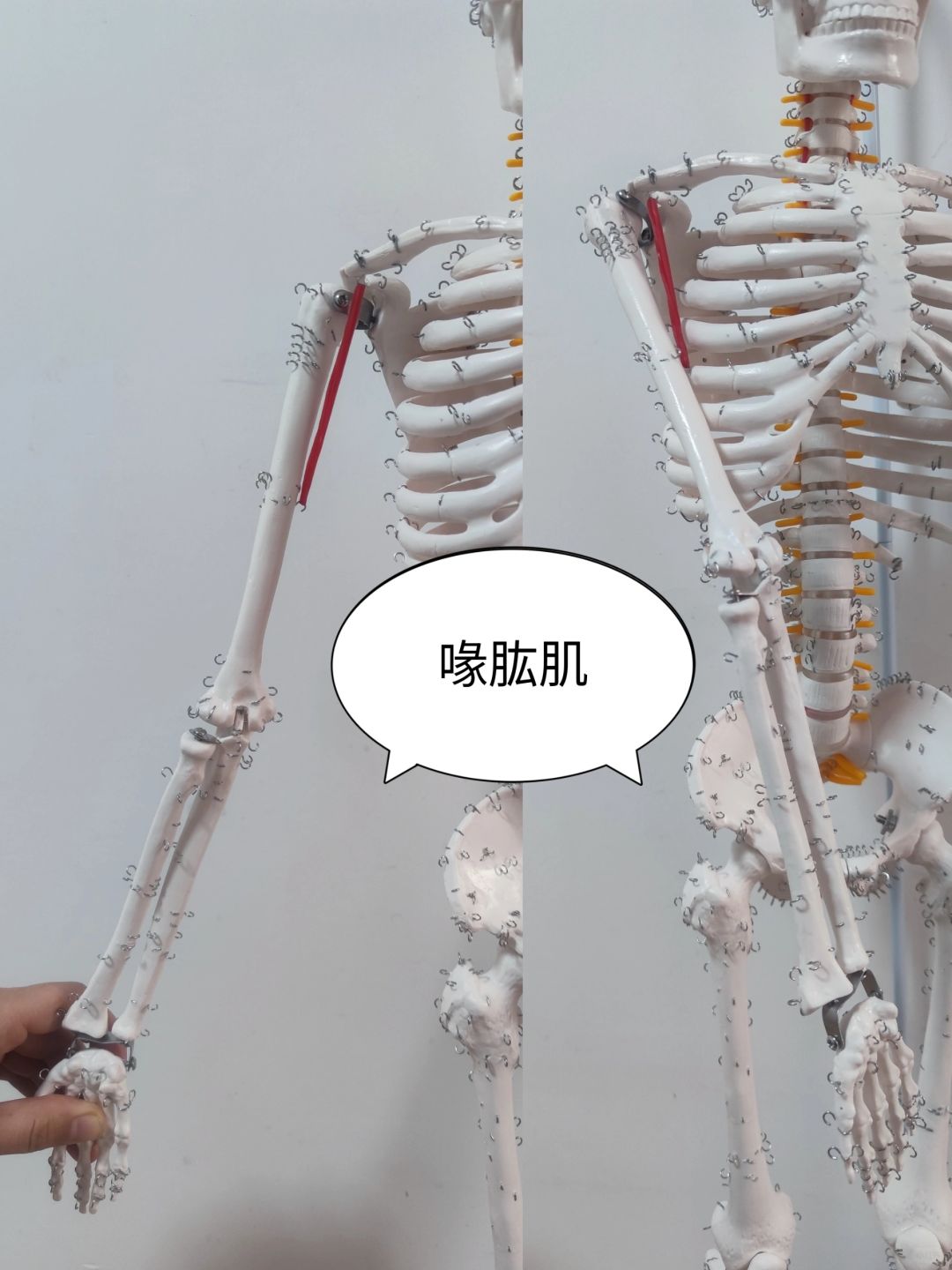 喙肱肌
