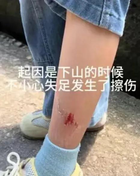 龟峰景区这事，让人心里挺堵得慌！

五一假期，一位妈妈带孩子爬山，娃不小心刮伤了