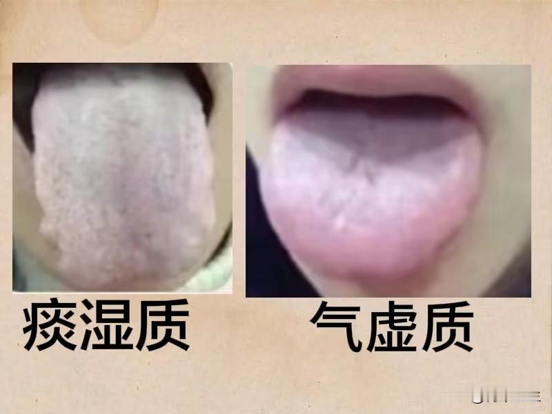 舌象挑战，今日继续！挑战一天看60个舌象，有需要，尽管来！注意，需使用原相机拍摄