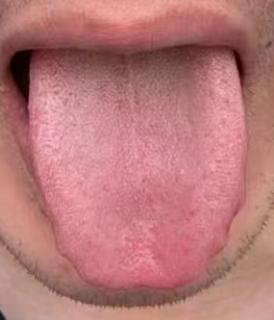 宗筋失养、气血不足？两招补气血祛寒湿，重拾充沛精力







很多朋友年纪轻