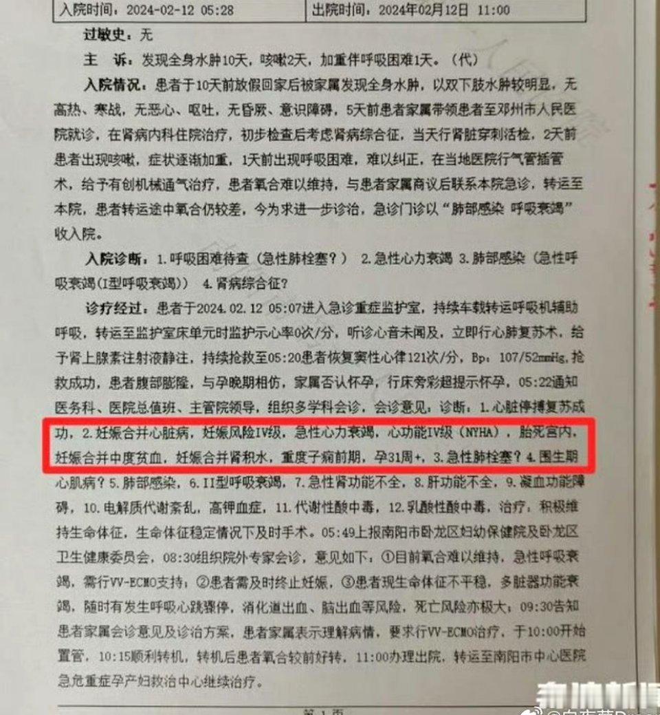 #怀孕女大学生发胖被误诊为肾病医治身亡#[微风]导致双下肢水肿的原因很多，肾病综