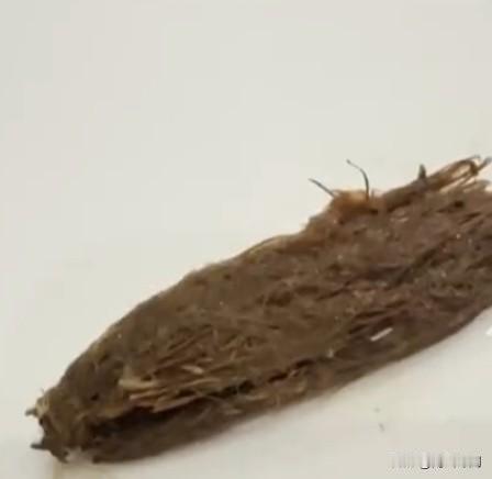 吃饭吃出异物本就糟心，广州这名男子的遭遇，简直让人隔着屏幕都觉得反胃。
 
男子