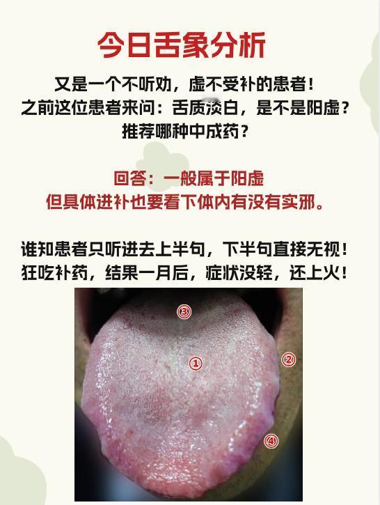 今日舌象分析
