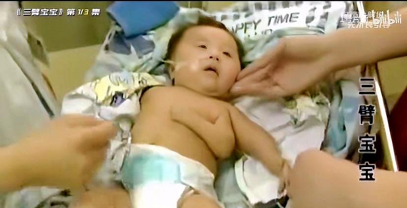 有些钱，真不是省出来的。
21岁姑娘因为没钱做产检，孩子一出生就带着先天问题，医