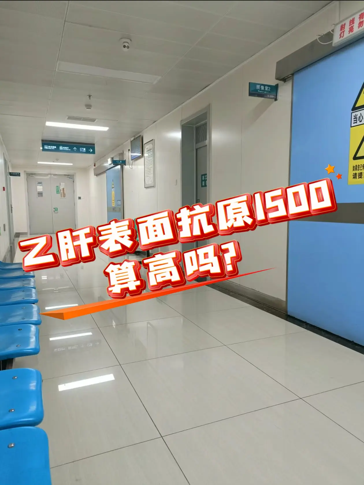 乙肝表面抗原1500算高吗？ 乙肝表面抗原的阳性，说明感染了乙肝病毒...