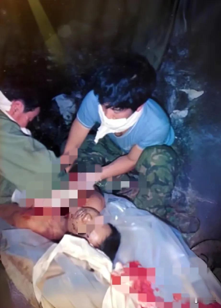 80年代，老山前线，战斗过后，一名牺牲的战士被转运到后方，两名战友正在把烈士因炮