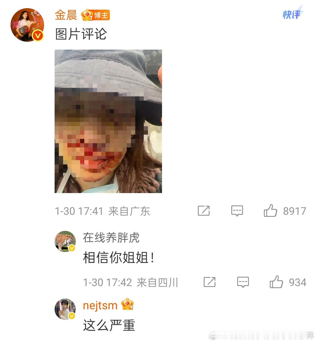 金晨发文道歉，说明自己当时因强势过重，先去就医并紧急进行了手术，后得知助理说是自