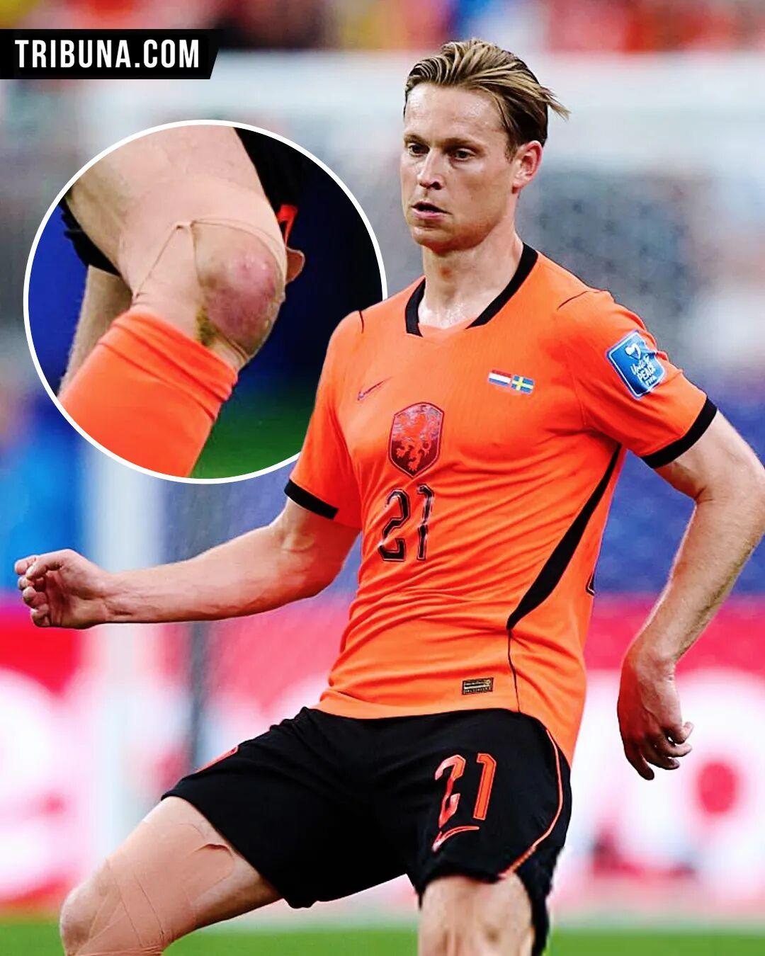荷兰队足球运动员弗兰基·德容（Frenkie de Jong）最近负伤登场比赛，