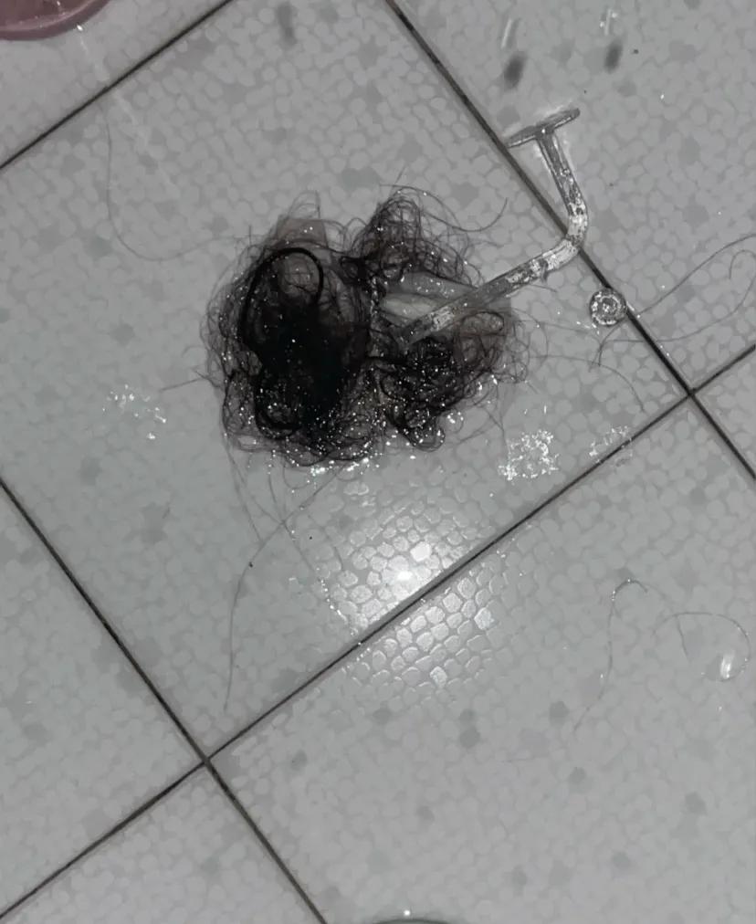 压力很大头发成把的掉一个月以前爷爷去世家里很多事情落在了我身上父母都是有点残疾的