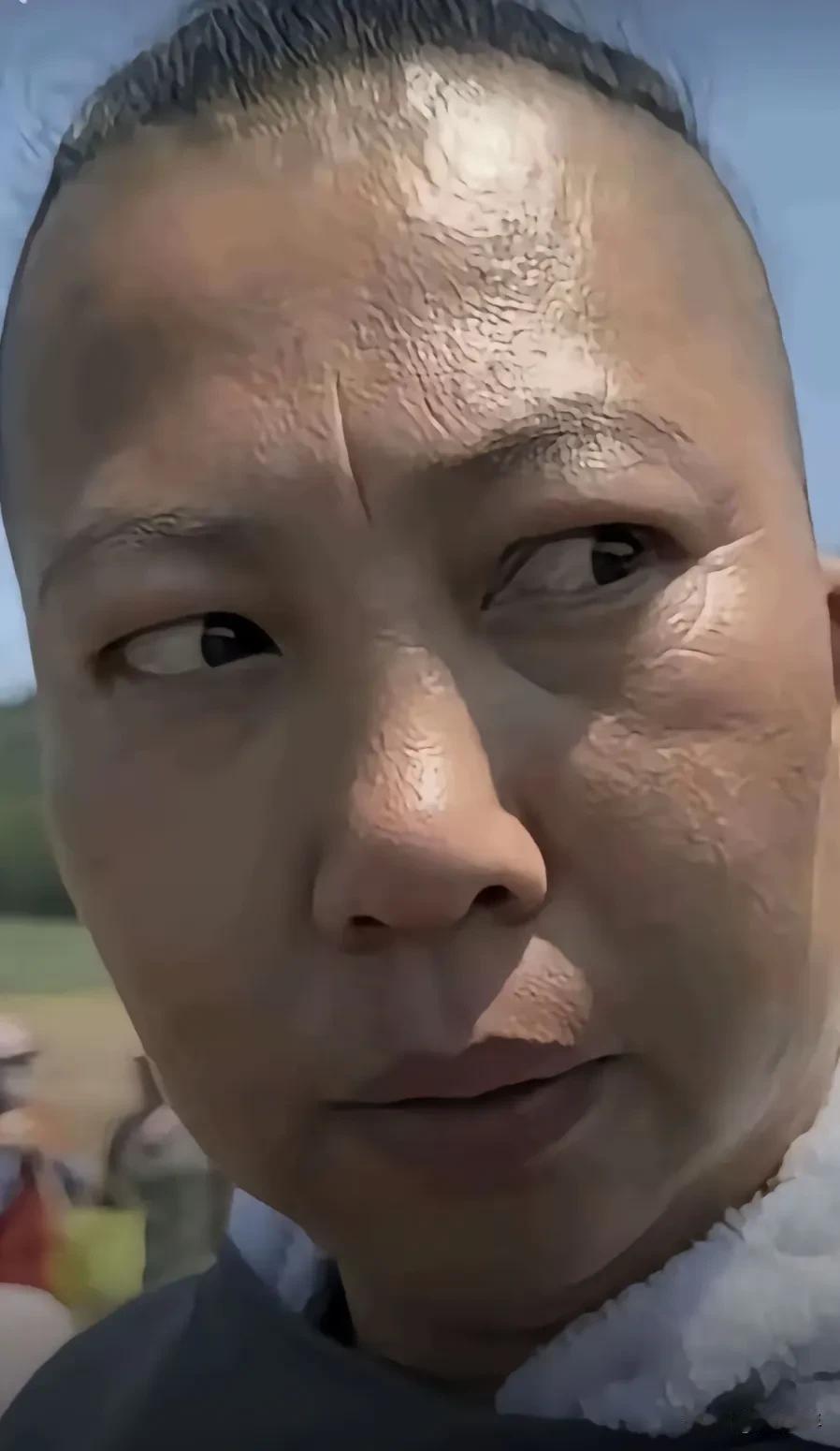 打完人给1万块和解，够狠啊，把人打成这德行了，脸都肿了，脑袋都破了，这还是生活在