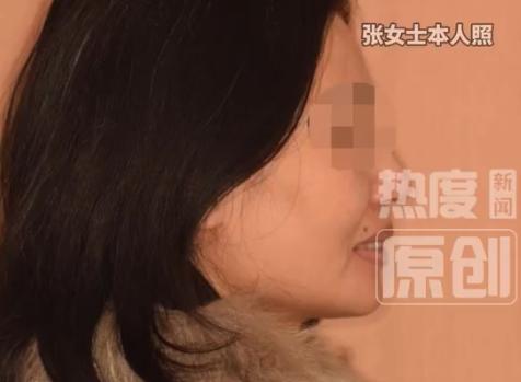 防不胜防！北京的张女士只是缺了两颗牙，本来想做个正畸收收缝再种牙，结果现在满口牙