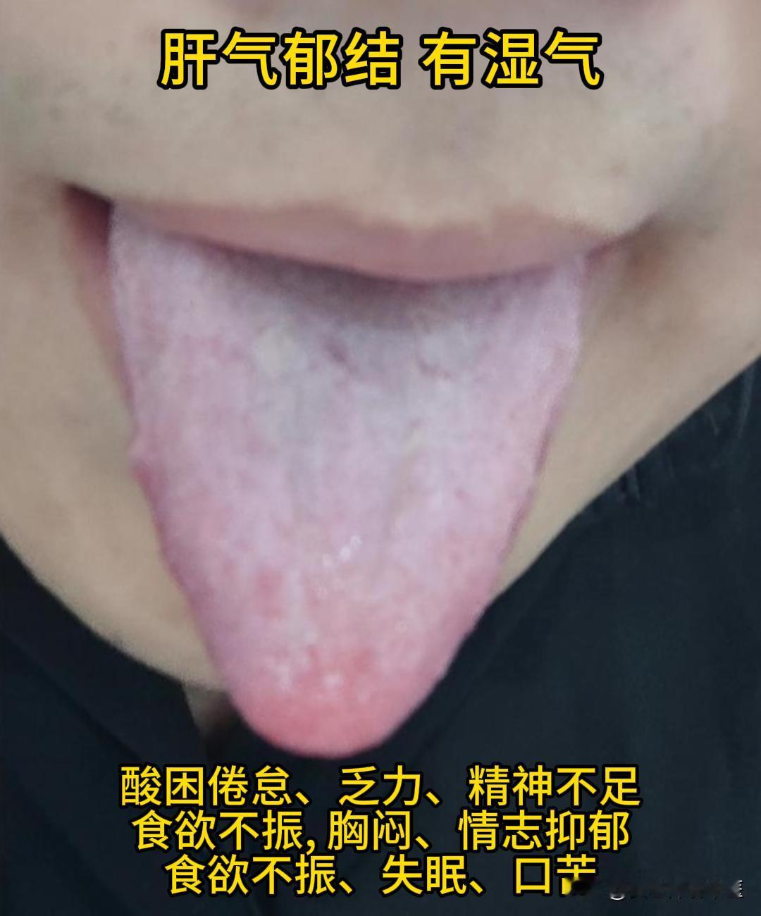 周日有时间，可以帮大家看看舌象。

有需要的，尽管把你的舌象照片发过来吧！越早发