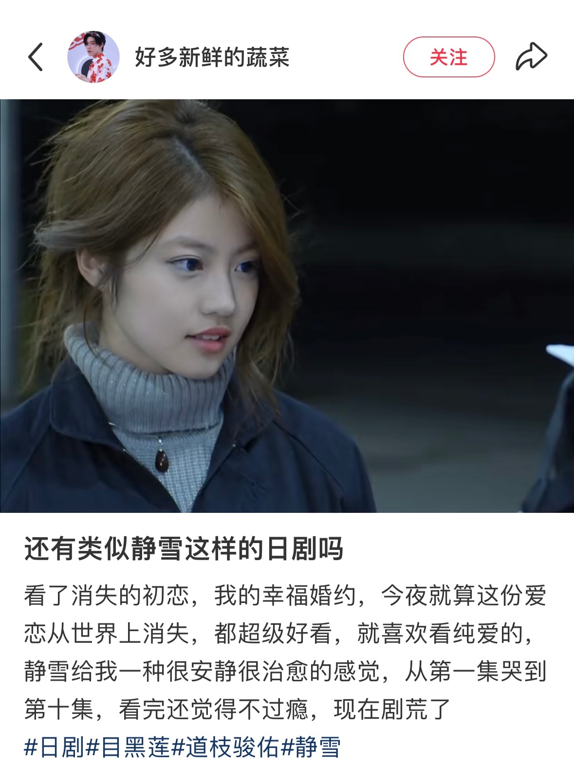 刷到今田美樱 也能欣赏到的一些高颅顶之美…✨ ​​​
