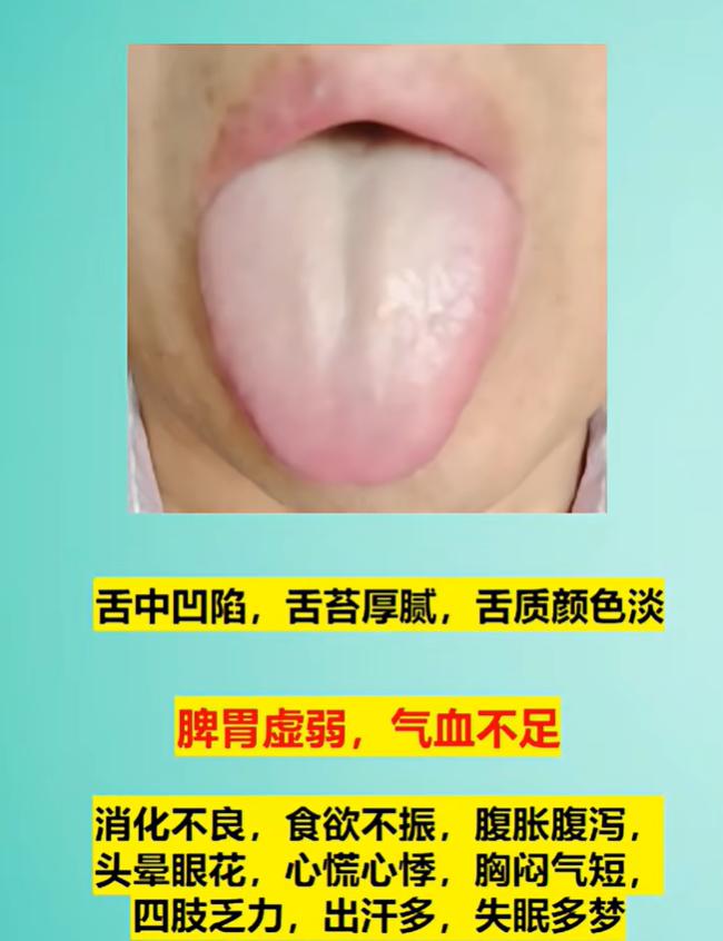腹胀乏力、失眠心烦，从舌头分辨三类脾胃亏虚问题