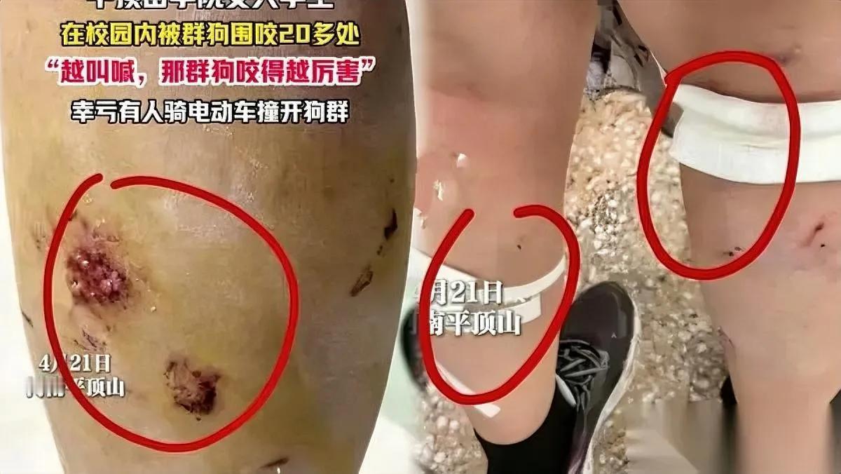 爱狗人士哑了

没人出声了

当年逼走保安的报应来了。

两年前平顶山学院保安清