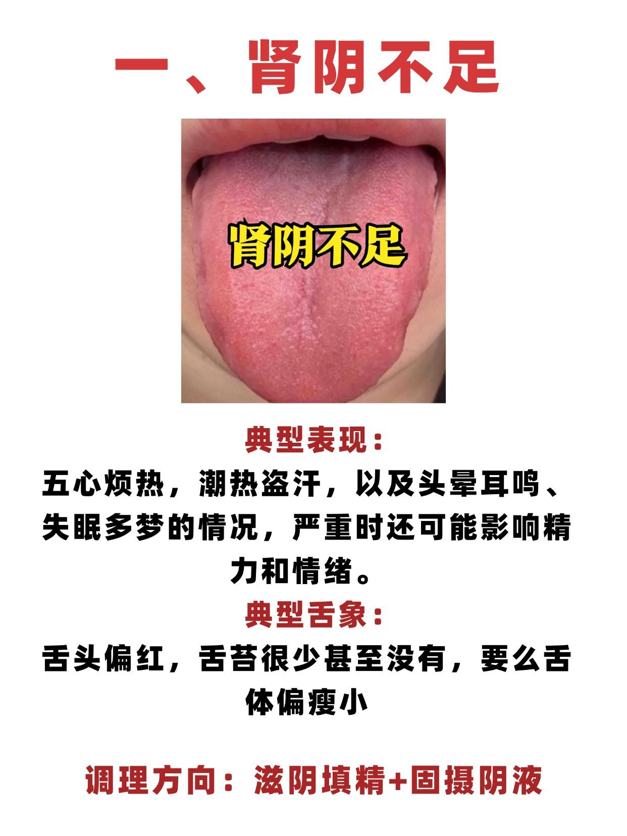 人有三阴，亏一阴、体难健！是哪三阴，中医通过舌头一次讲明白！