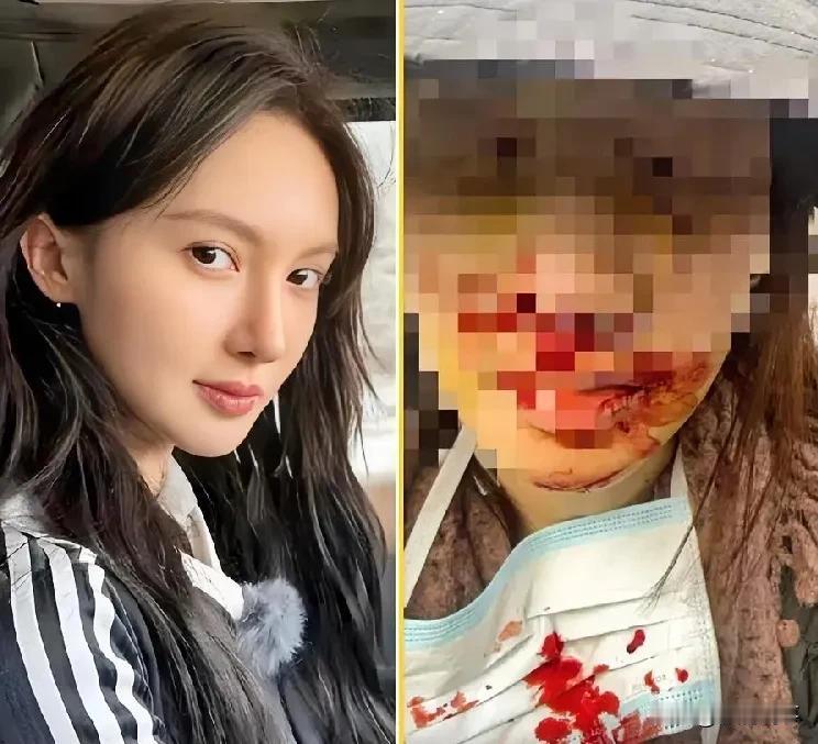 我做整形的朋友刷到金晨受伤看病的新闻，跟我说了几个脸部受伤该咋就医的常识，特别实