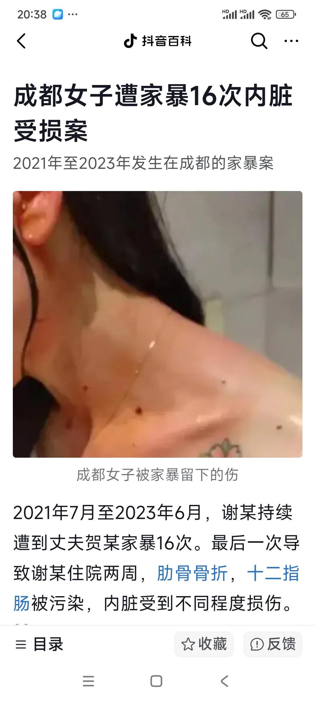 是什么样的家庭，会让自己儿子家暴妻子16次，让她左肾功能完全丧失，终身挂着尿袋，