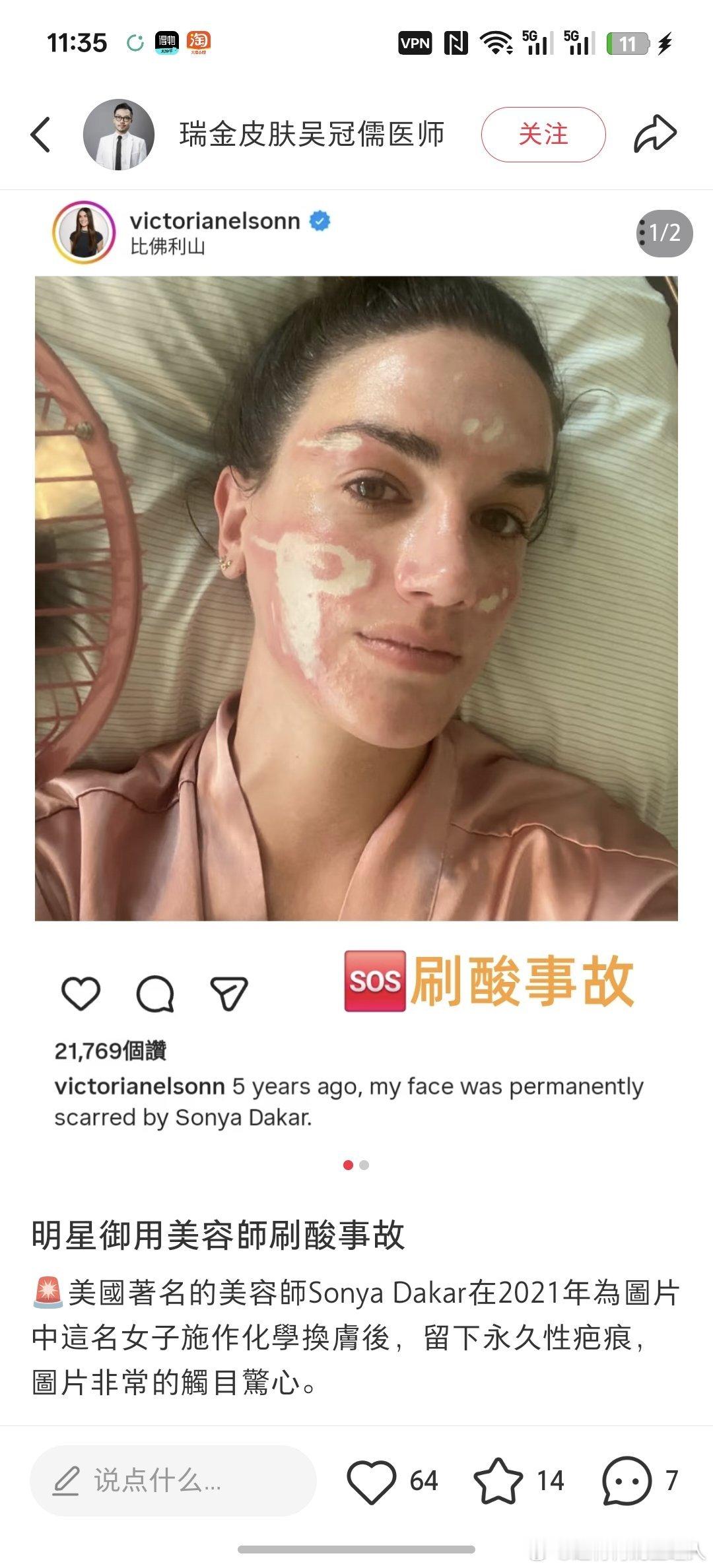 白人都刷成这样娇嫩的黄种人更不要自己尝试 