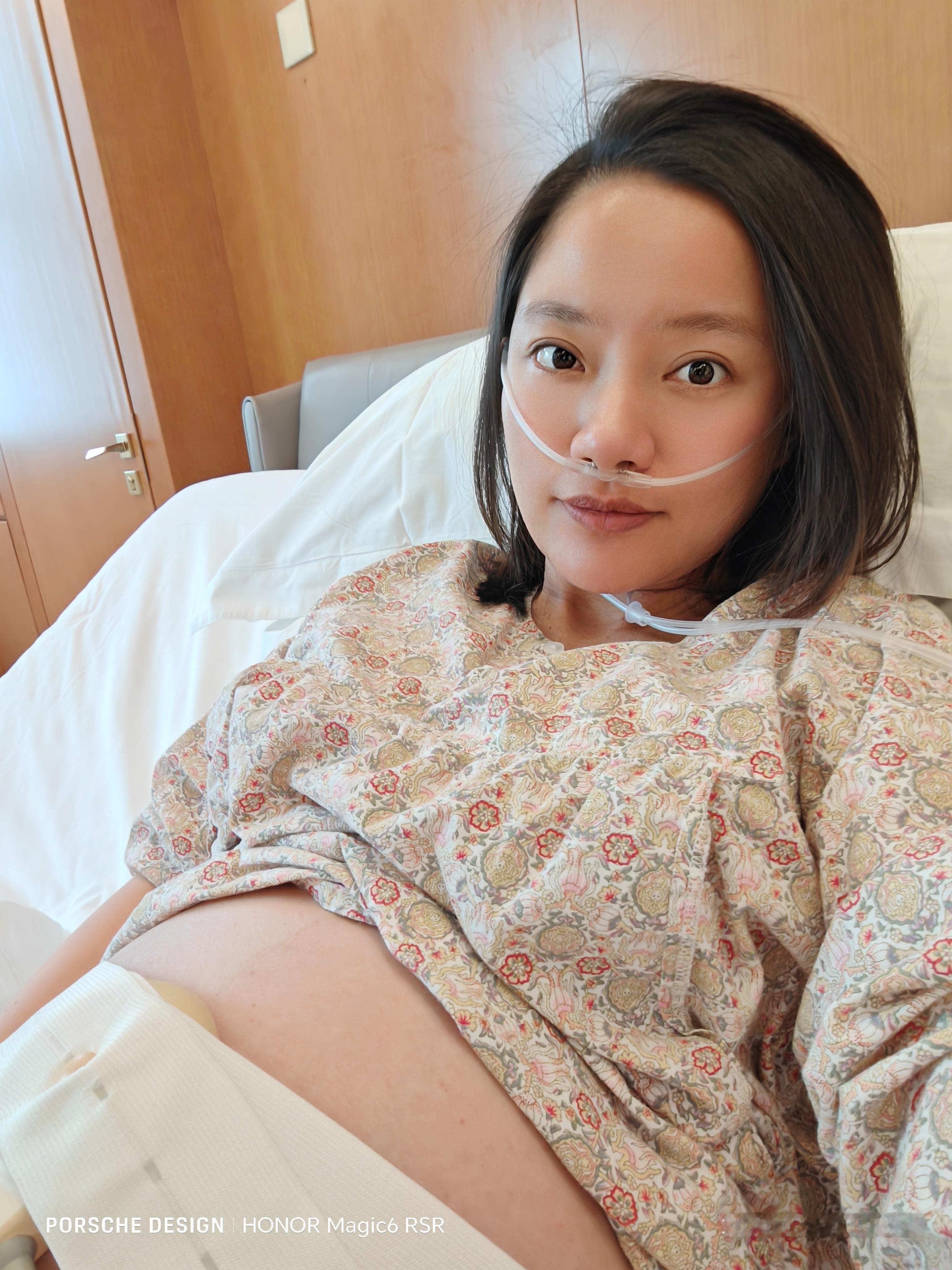 长胖30斤对面部改变有多大这是我的30斤前后~当时就想着这辈子猛猛胖一次。（算上