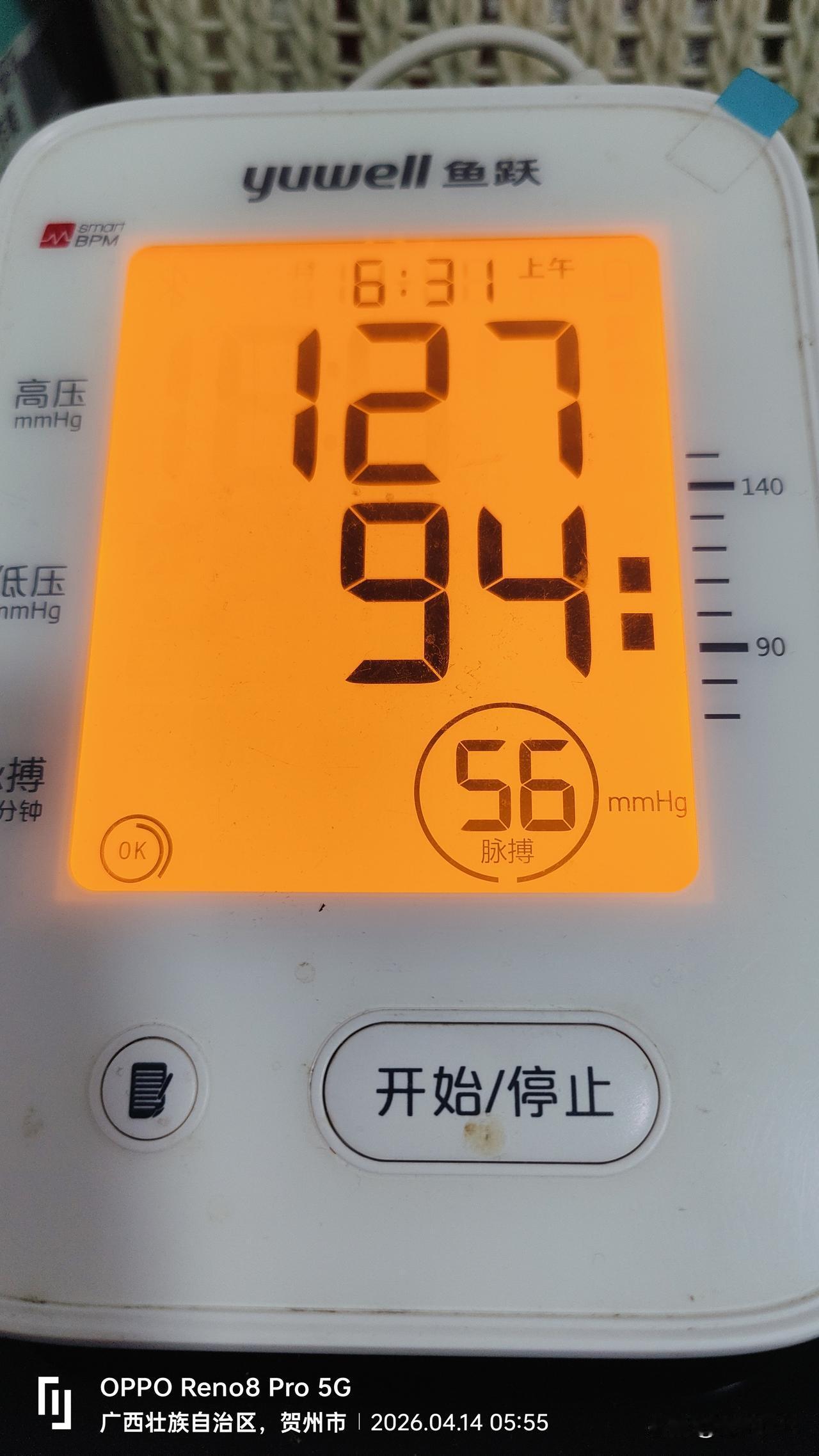 花300多块买了个“惊吓大礼包”——低压偏高，总胆固醇也高。医生吓唬我说可能脑梗