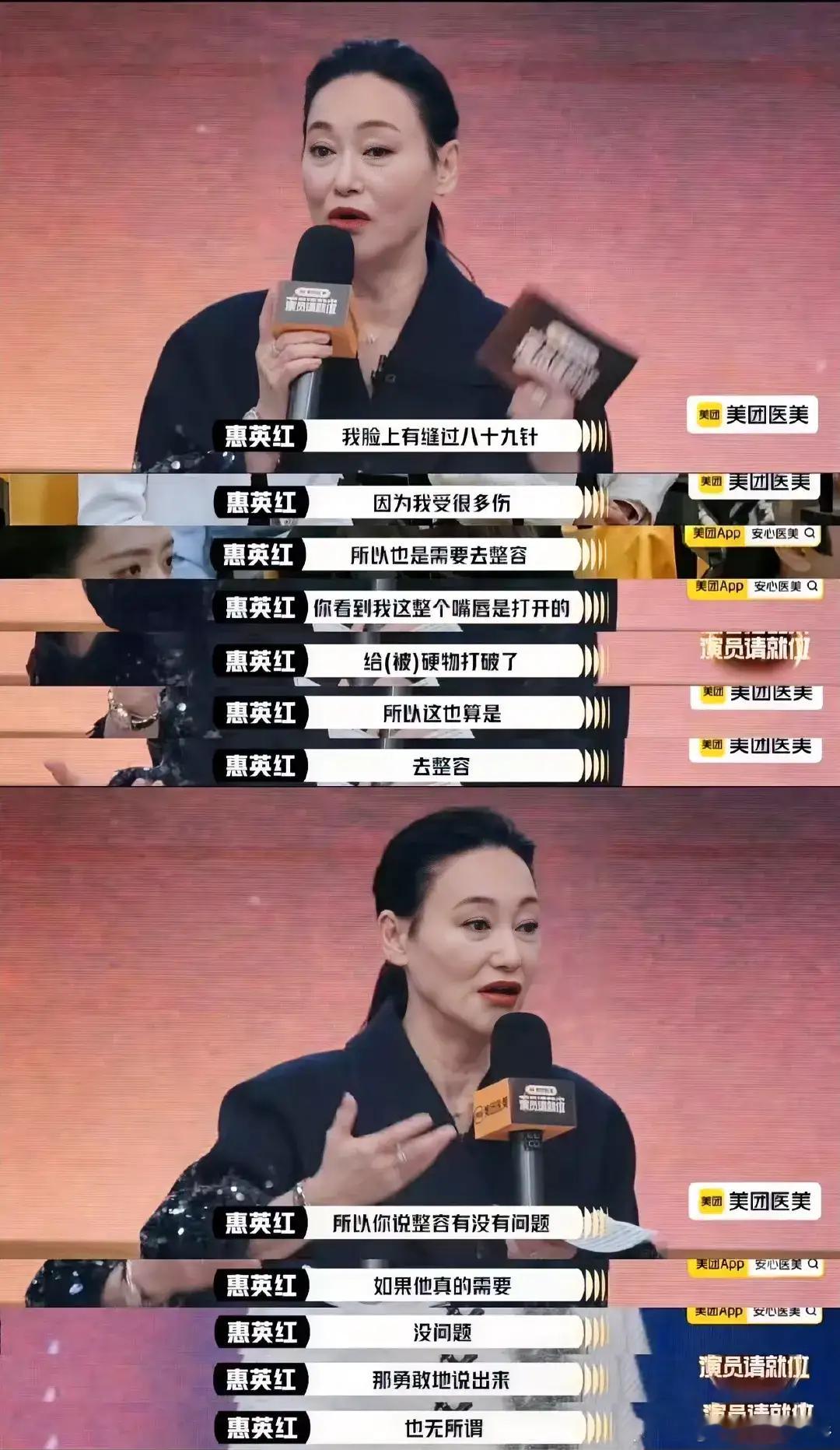 惠英红是《演员请就位3》的导师，问学员们是否整容并且能诚实回答，然后自己解释了整