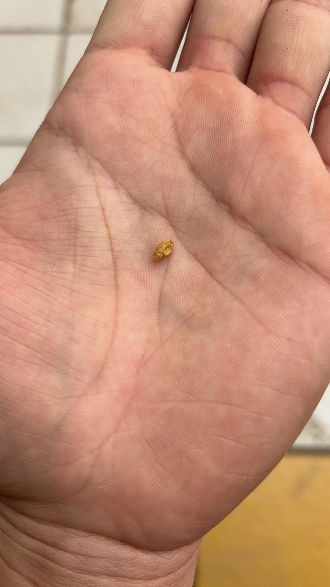 我再也不会迷恋这种生活 折磨我两年的石头终于出来了