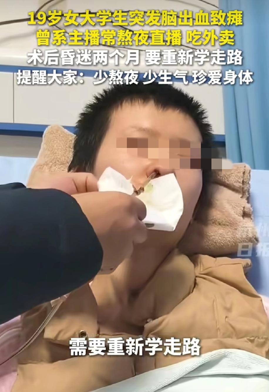 19岁女大学生被确诊脑出血致身体瘫痪！
只因她犯了一件大多数主播常犯的错熬夜，点