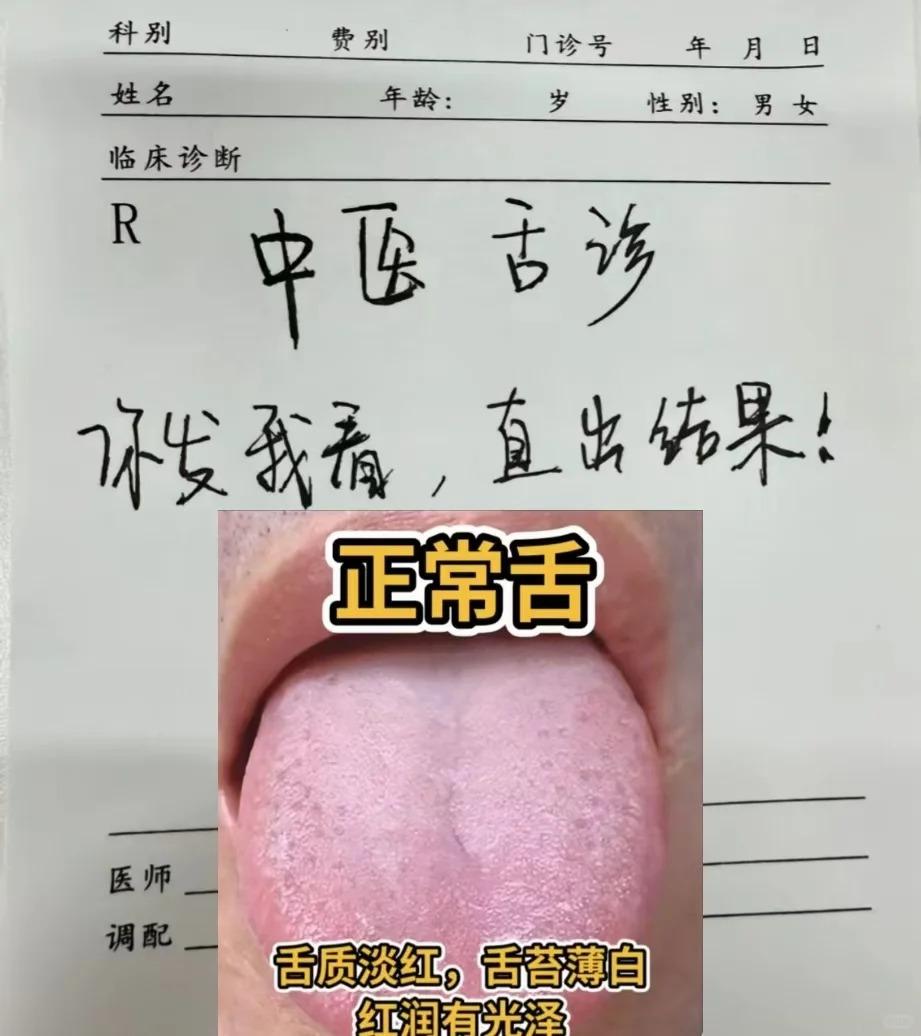 今天不是很忙，继续挑战全网看舌象，你发我就看，直接出结果！

还是老规矩，图片拍