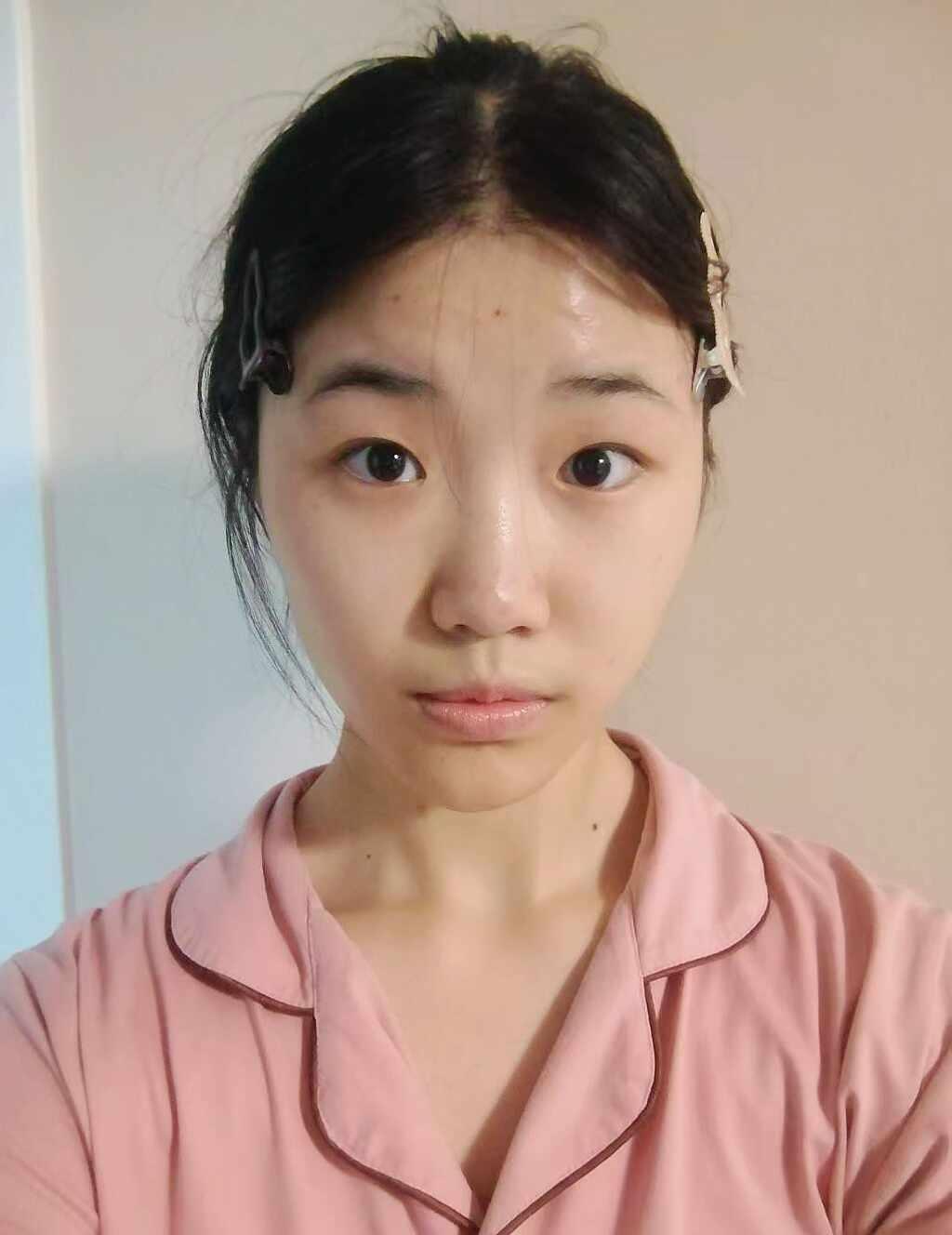 前后置为什么差别那么大？！
后置拍出来总是显凶怎么办？前置和后置 后置摄像头脸歪