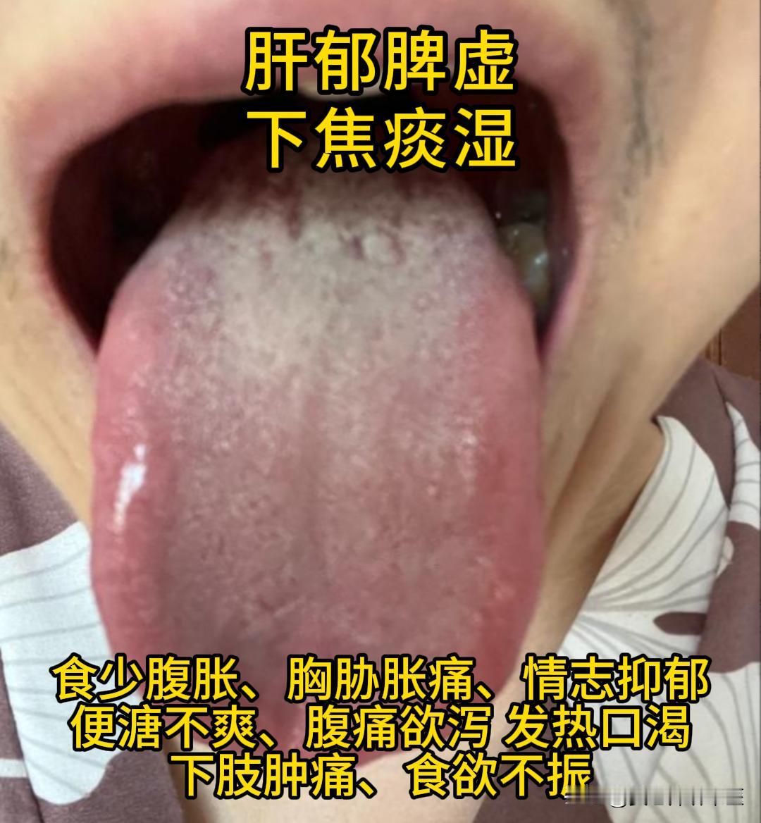 今天有空，可以帮大家看看舌象。
有需要的，尽管把你的舌象照片发过来吧！越早发，我