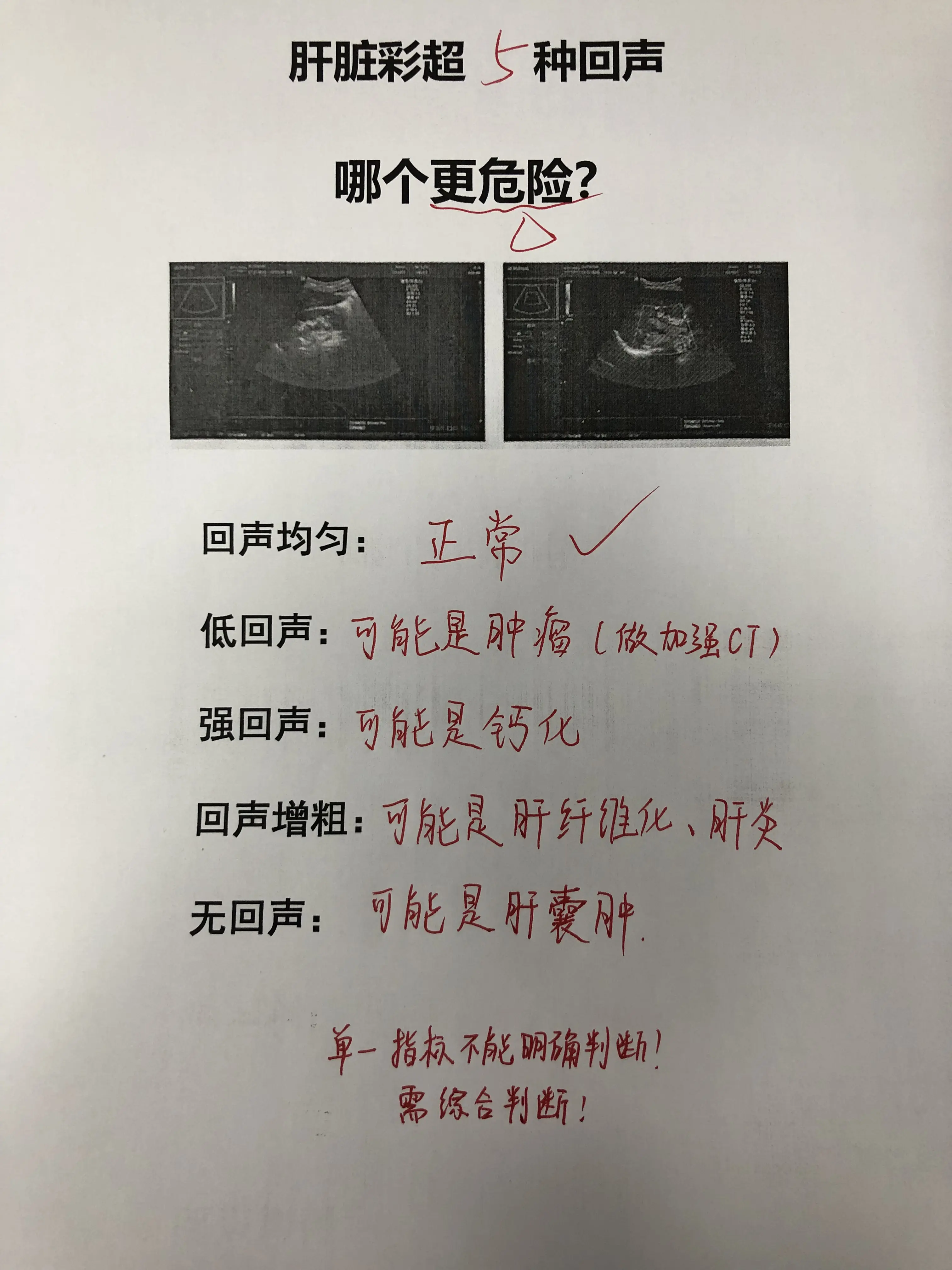 肝脏彩超 乙肝 肿瘤 健康科普 肝病教授陈士俊