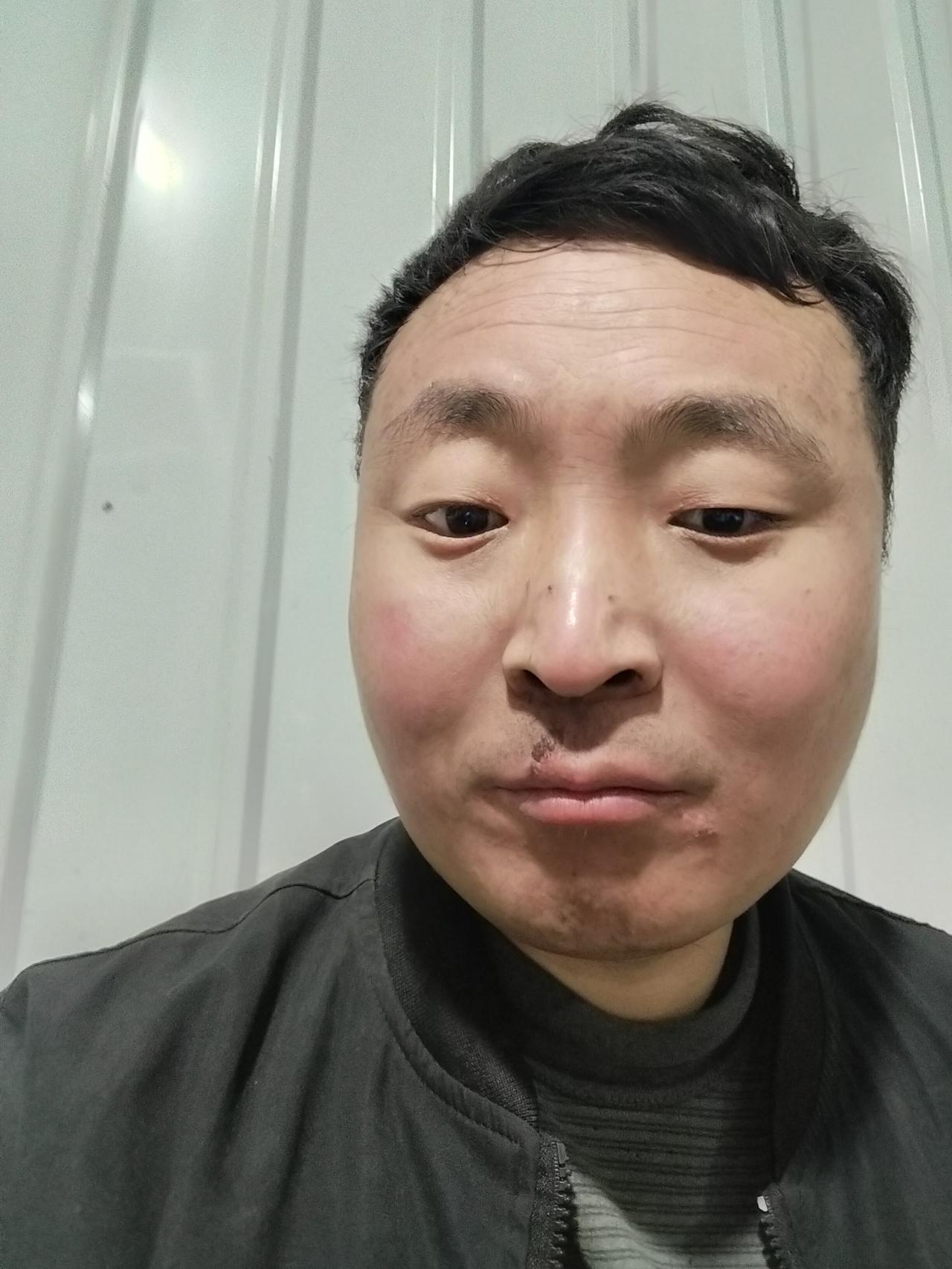 大理这边一下午活干完了，大夜回昆明，上火了还没有好。