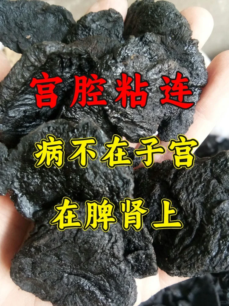 宫腔粘连，病在脾肾上❗