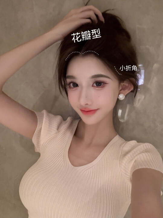 二次植发丨不剃发植发丨终于get头包脸！