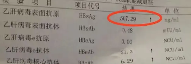 潍坊小三阳患者，表面抗原500多，能打干扰素吗？ 山东潍坊乙肝患者咨询...