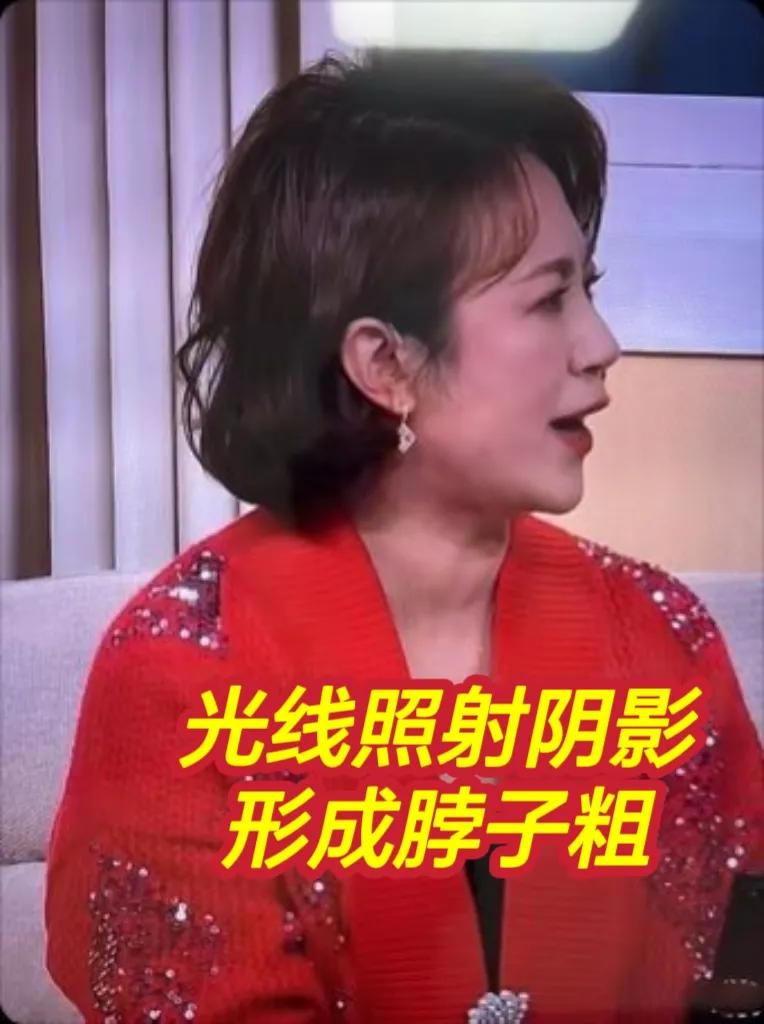 2025年央视春晚，马丽小品《金龟婿》赢好评，但颈部肿大引关注。网友猜测其甲状腺