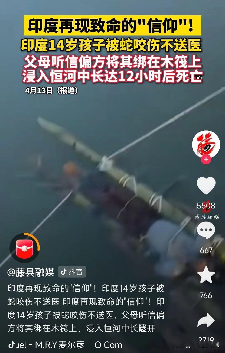 印度真的很神奇！
近日，印度有一14岁男孩被蛇咬，父母不信医生，信巫术，听信巫师