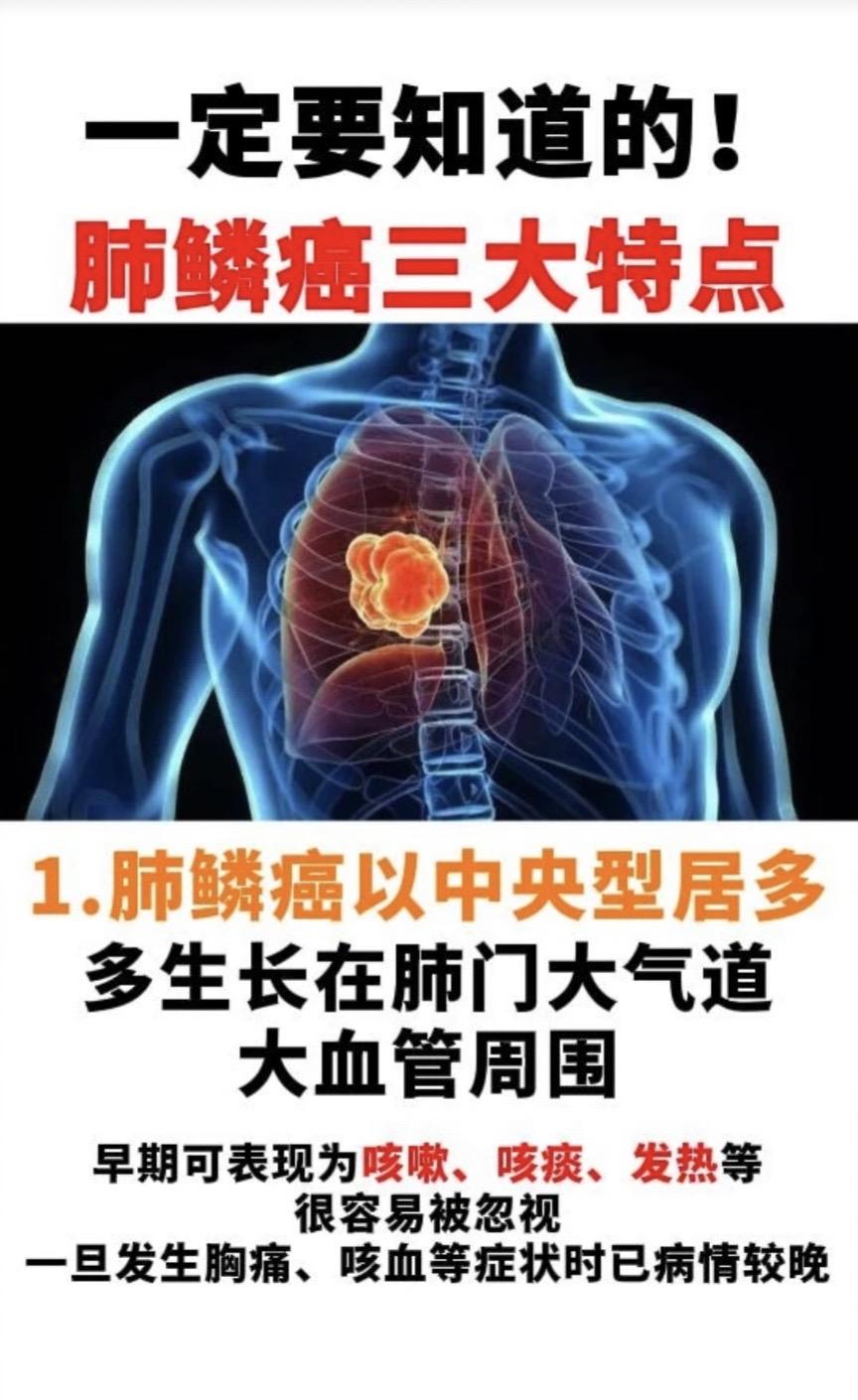 一定要知道的！肺鳞癌三大特点。