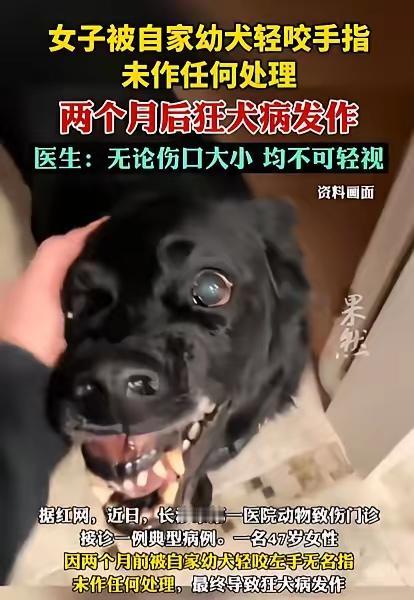 意外还是发生了！长沙一47岁女子，逗自家小狗玩，手指被轻轻咬了下。没破皮没流血，