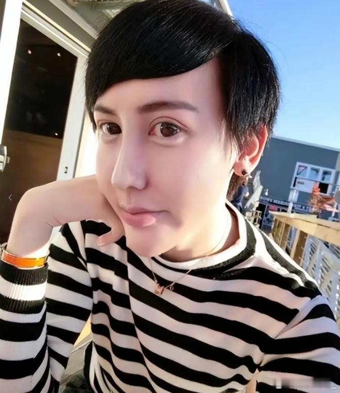 那是因为他是网红，有整容好的案例的话，他都会做成模板给客户看，他现在就是模特而已