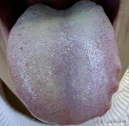 化瘀先疏肝、疏肝先升阳！教你1招，疏肝郁、升肝阳，通一身淤堵
这位粉丝平时呢身上