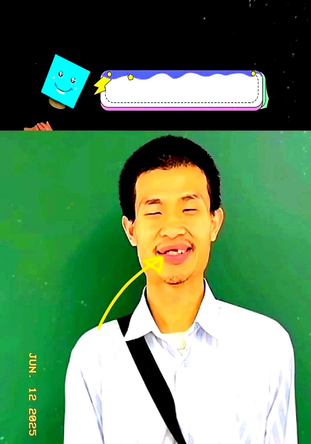 前几天韦东奕去校医院看牙，说要做义齿，没成想，没过两天北大医学部专家直接带器械到
