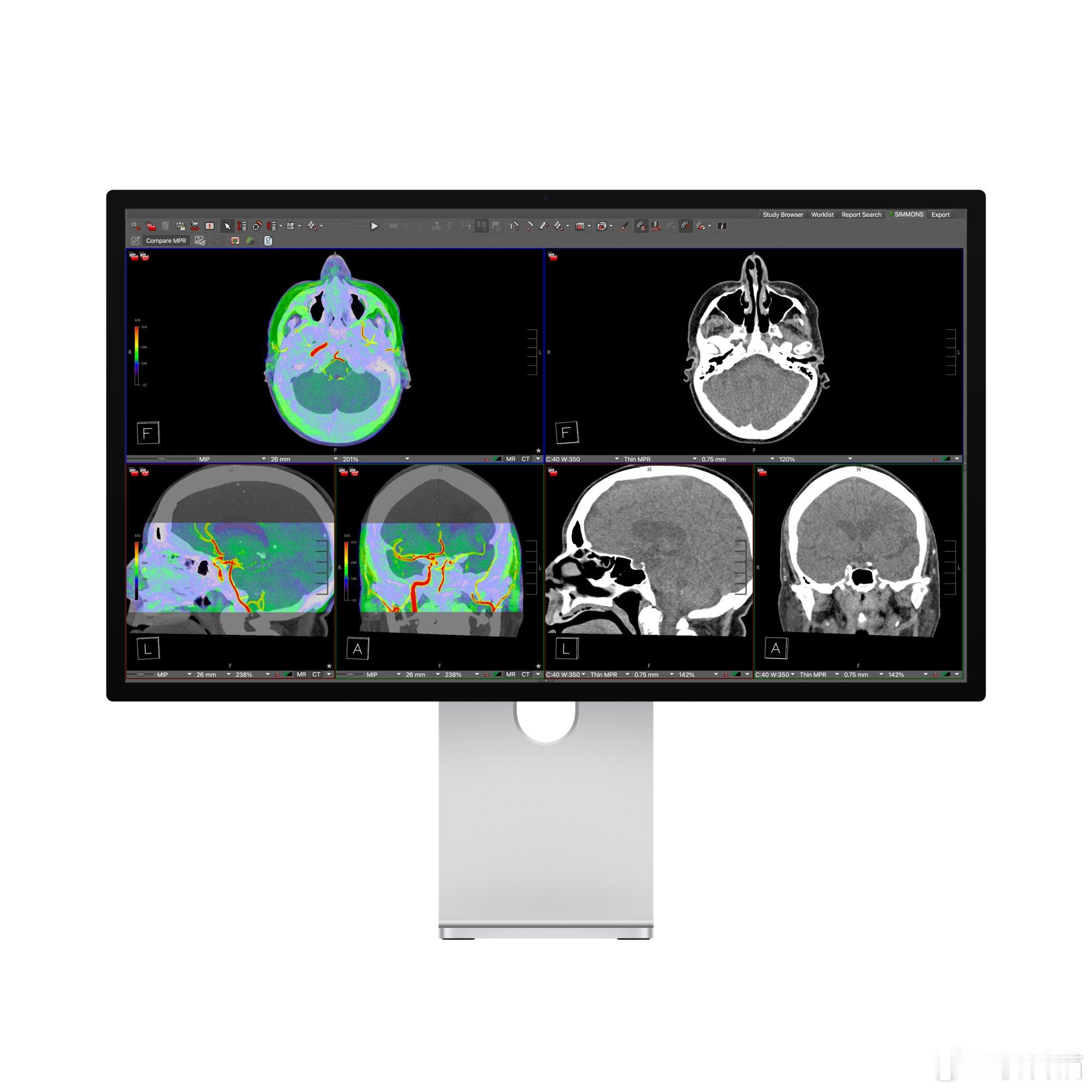 苹果 Studio Display XDR 显示器获得美国食品药品监督管理局（F
