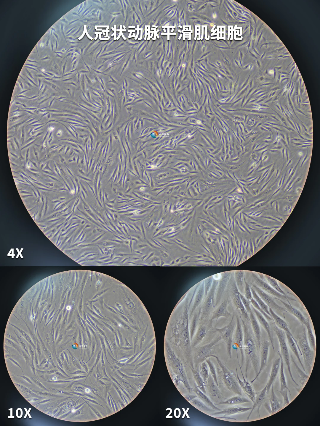 人冠状动脉平滑肌细胞，今天养这个细胞~