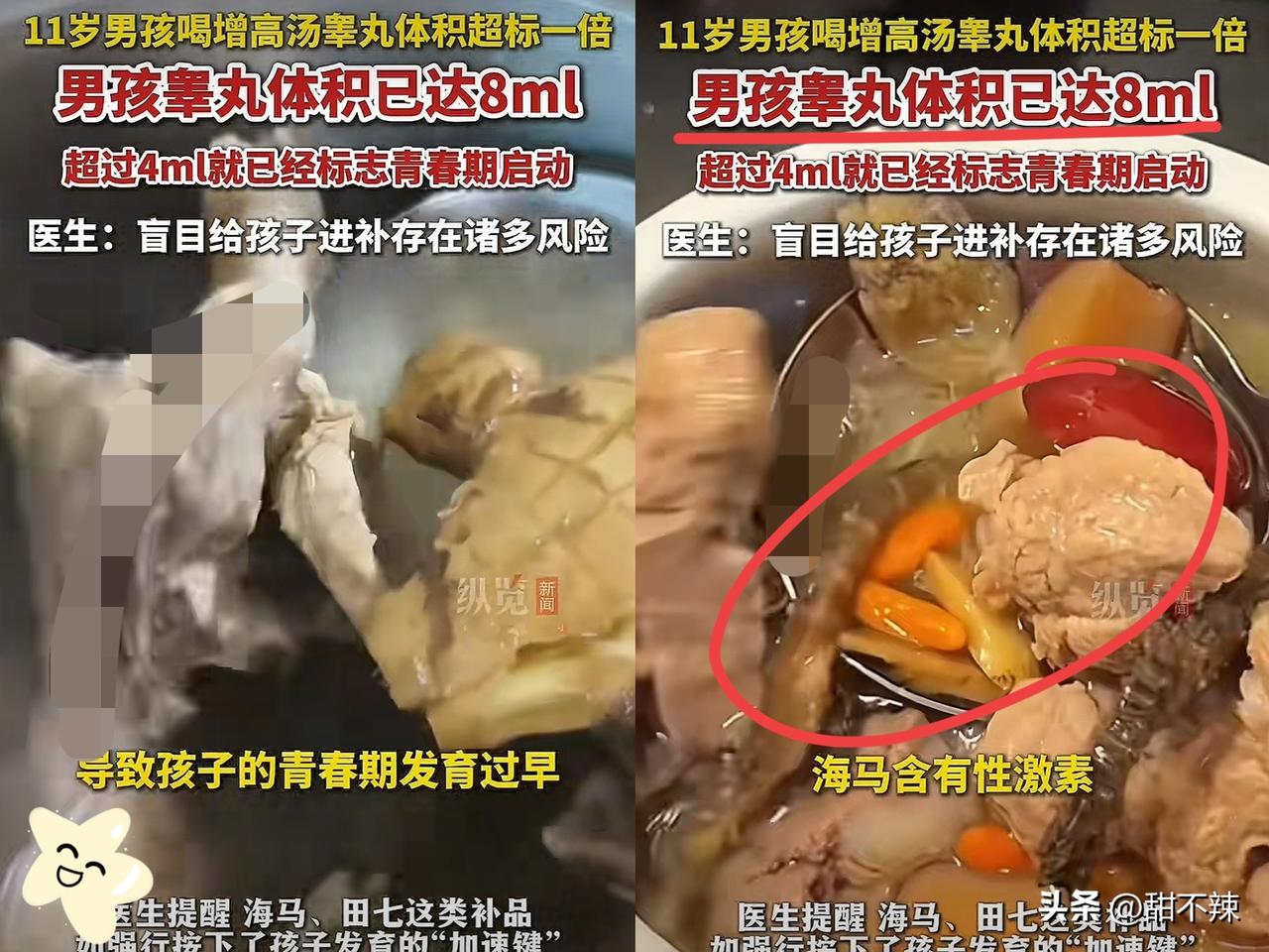 担心的事情还是发生了！
 
广东佛山一位妈妈怕11岁儿子

长不到175，天天熬