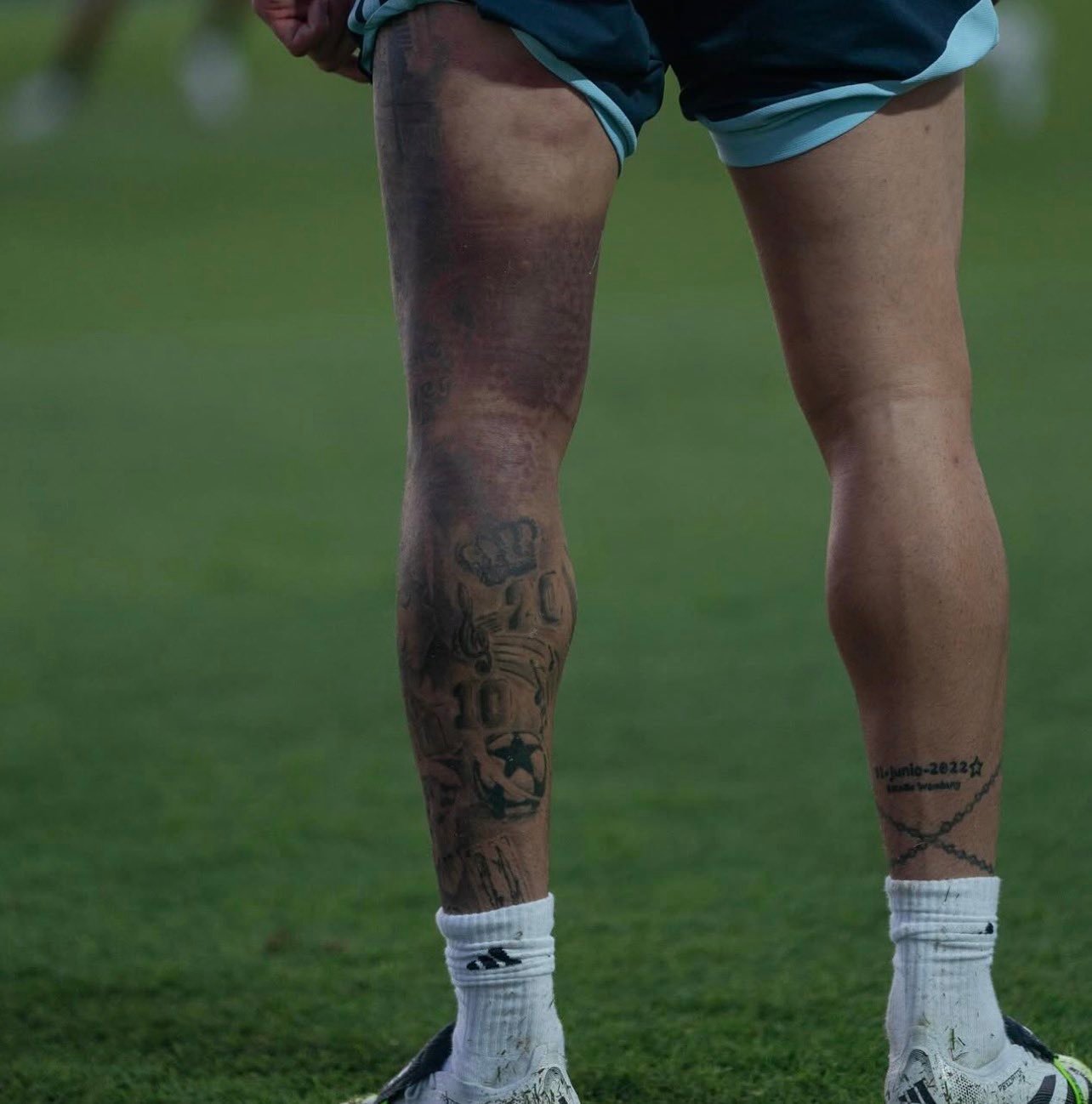 德保罗左大腿后侧还有一些淤青，这是上周中对阵纳什维尔时受的伤。德保罗回阿根廷国家