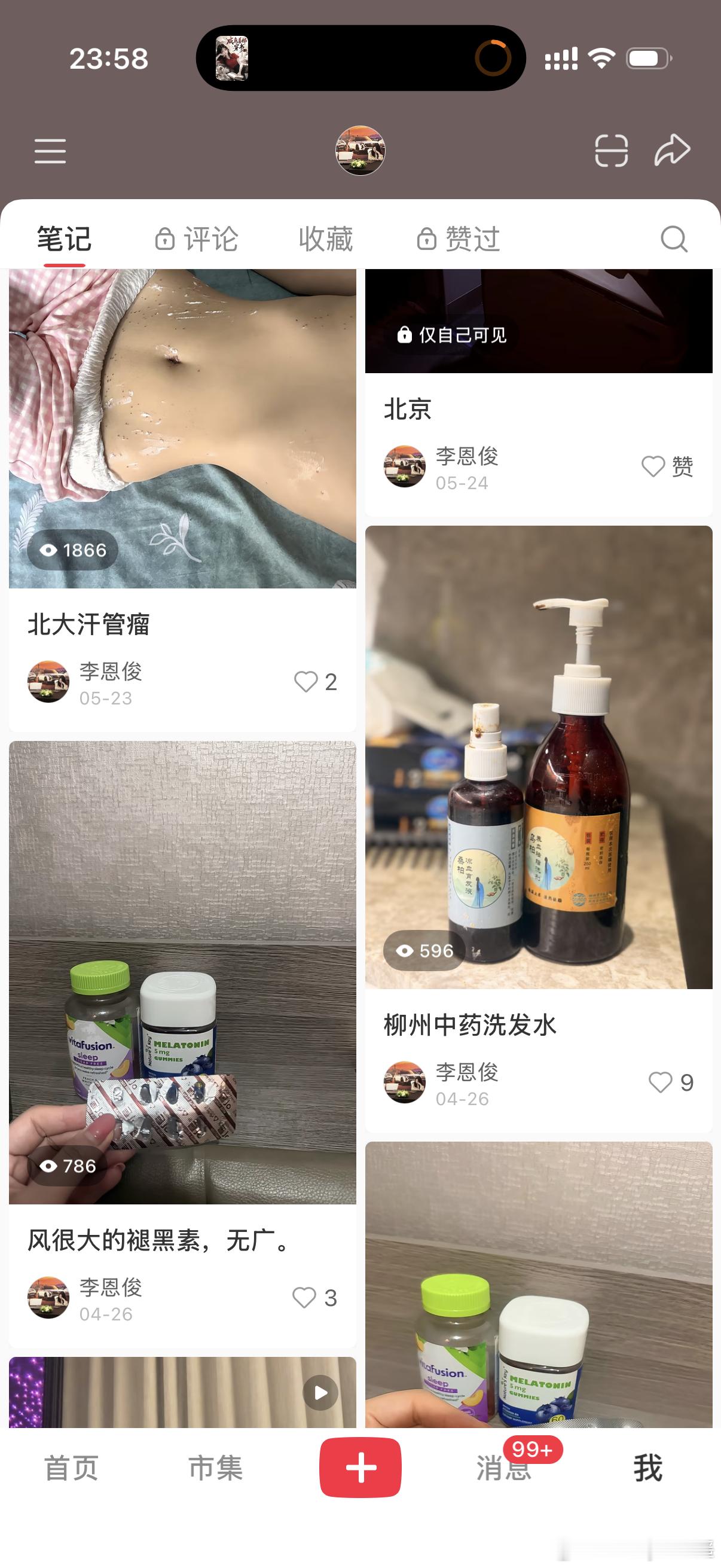 洗发水分享过啦 这个是柳州中药洗发水 医院线上开 然后邮寄 邮寄费用23还是26