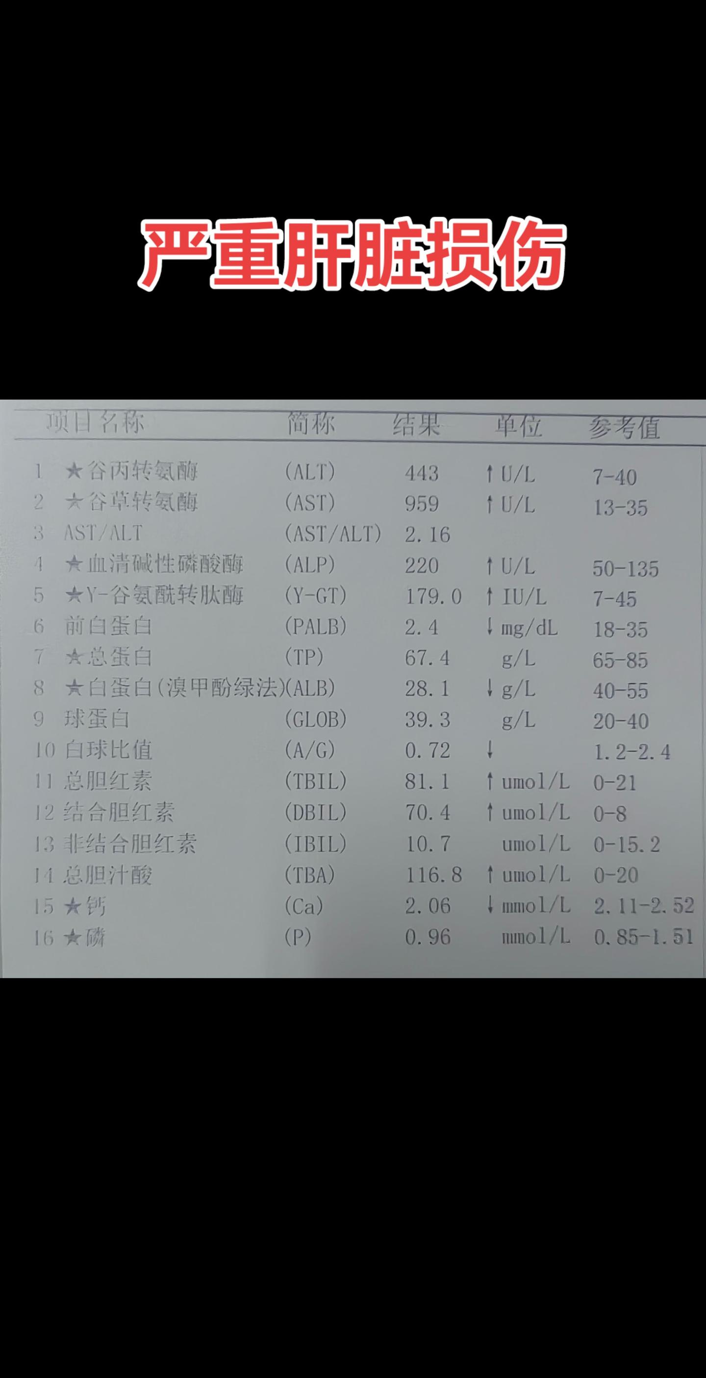 肝脏损伤。患者为老年人，因恶心、纳差、食欲减退住院治疗，查体皮肤巩膜略...
