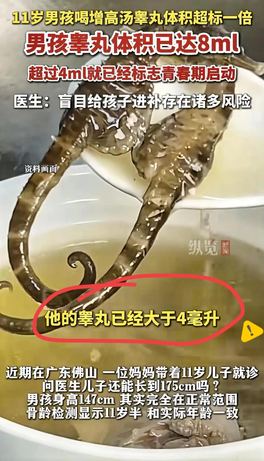 真没见过这么坑娃的！

佛山一位妈妈怕11岁儿子长不到175，天天熬海马田七汤补
